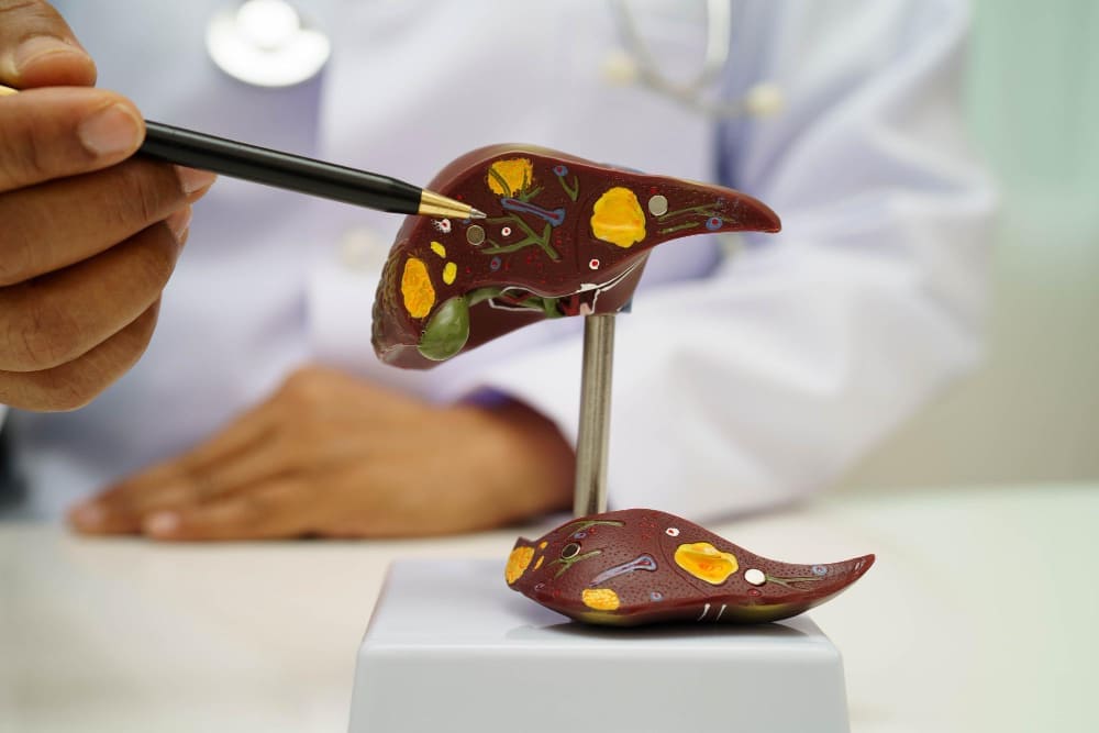 Manejo médico de la pancreatitis